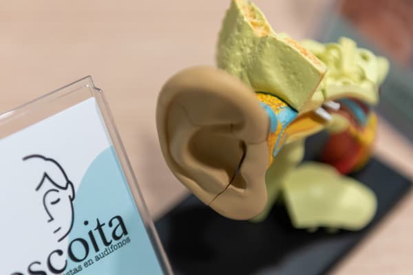 Audífonos en Allariz